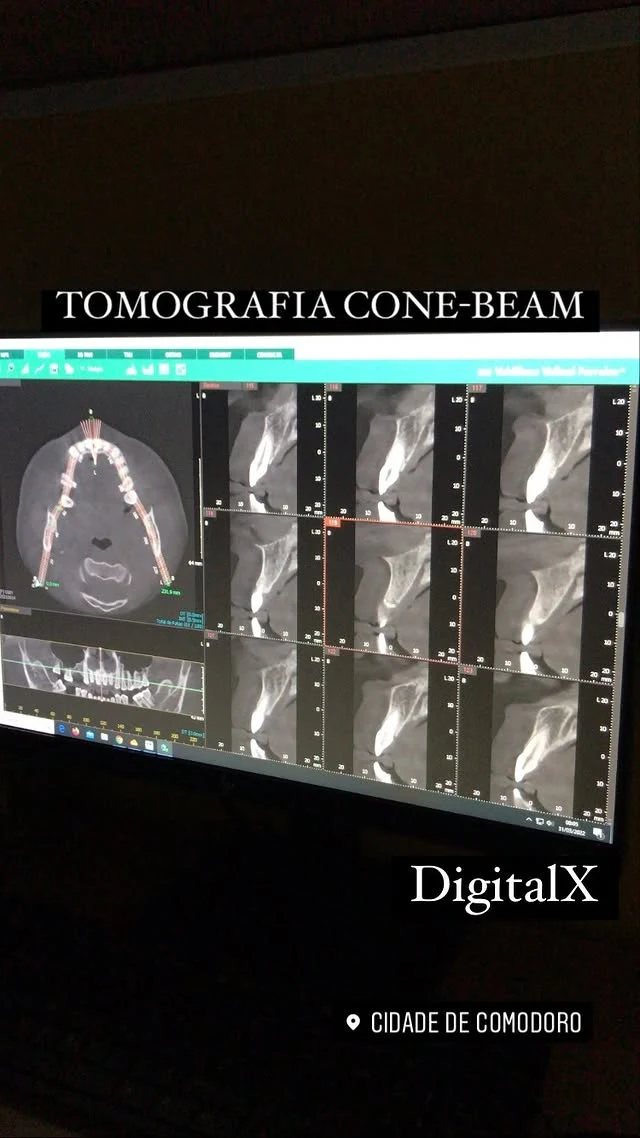 Imagens de tomografia odontológica em diferentes planos