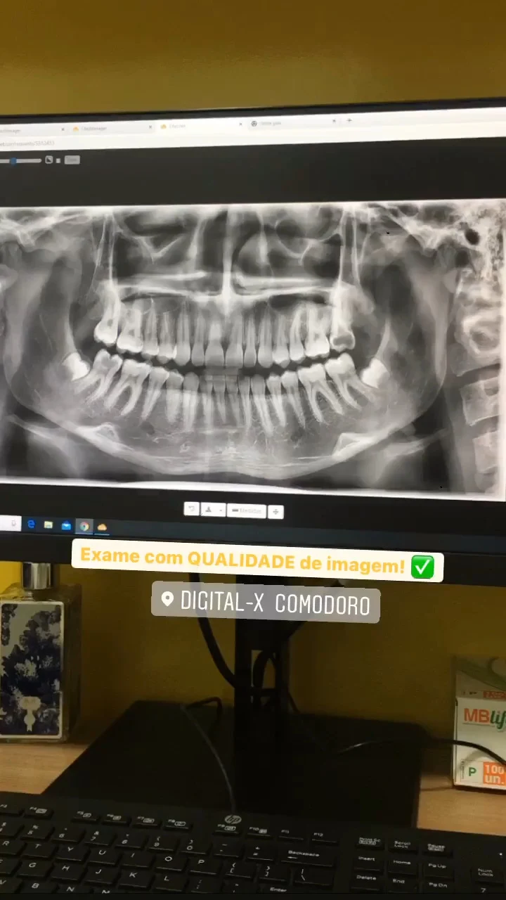 Imagem panorâmica odontológica exibida em monitor