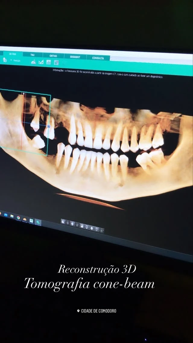 Reconstrução tridimensional exibida no monitor da DigitalX