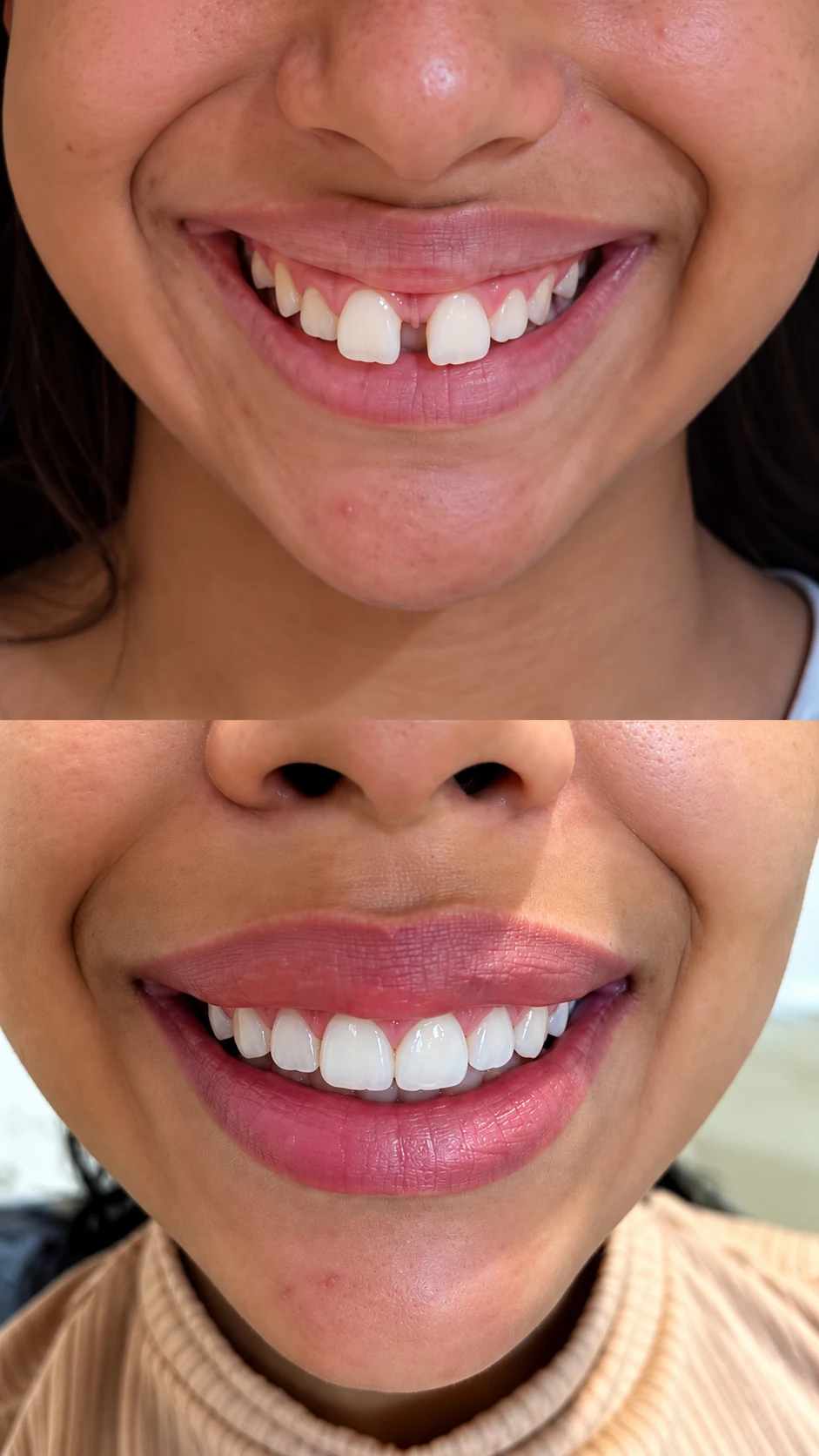 Montagem com dois registros de um sorriso