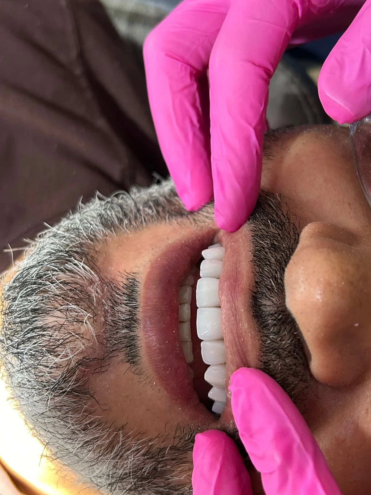 Registro aproximado de um sorriso